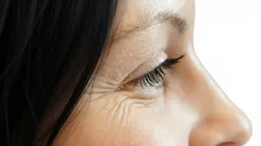 Proč se kolem očí objevují vrásky: pět faktorů, kterým málokdo věnuje pozornost